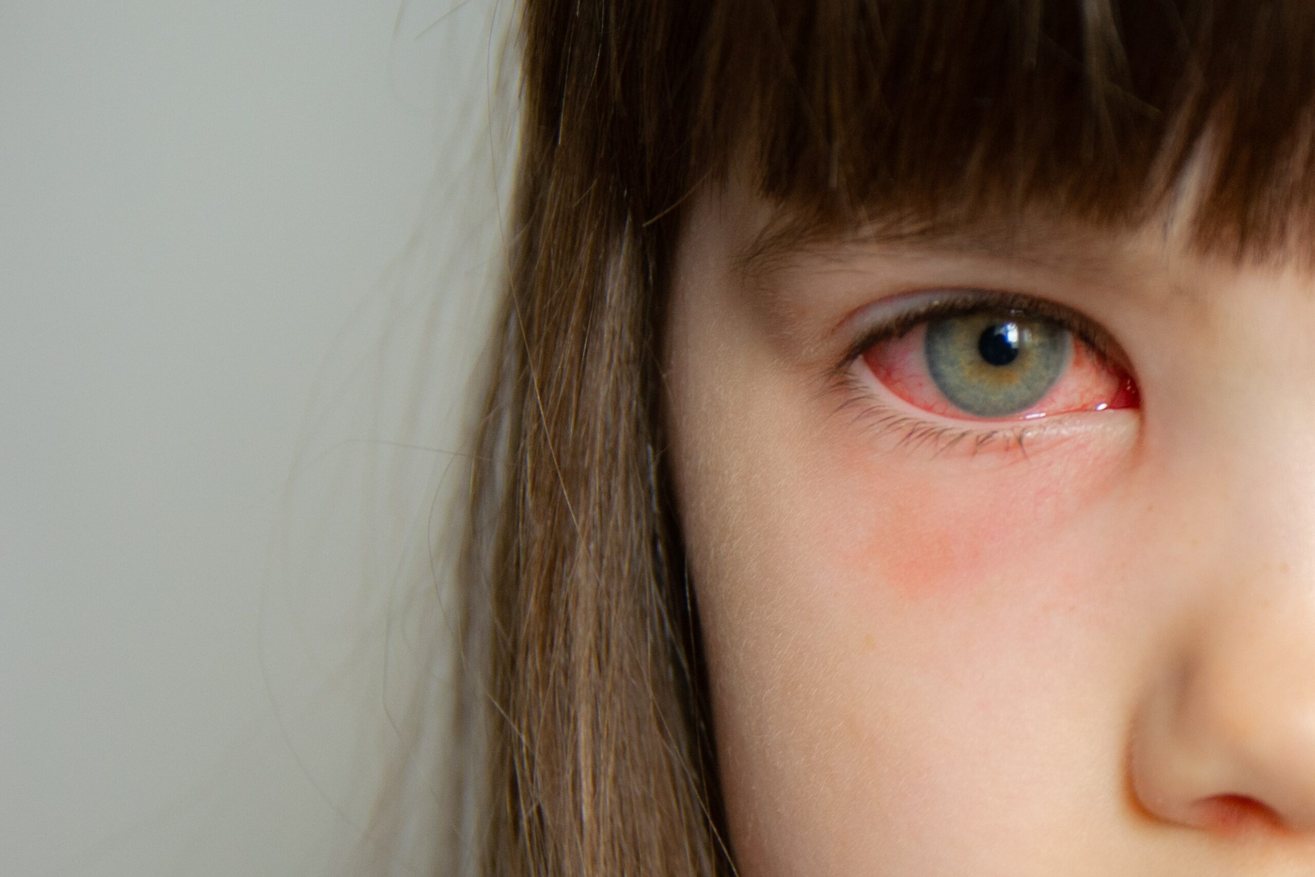 common eye problems in children