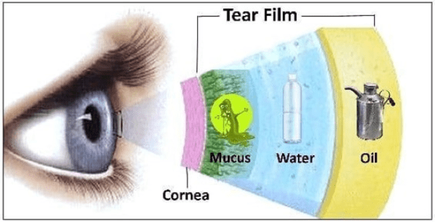 Dry Eye Type Cause Symptoms Diagnosis Treatment Prevention 6779