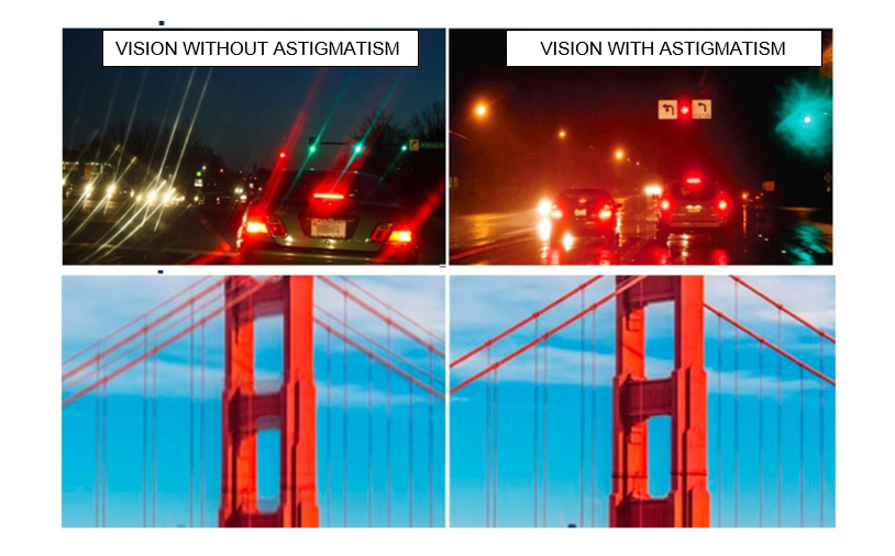 Astigmatism Vision