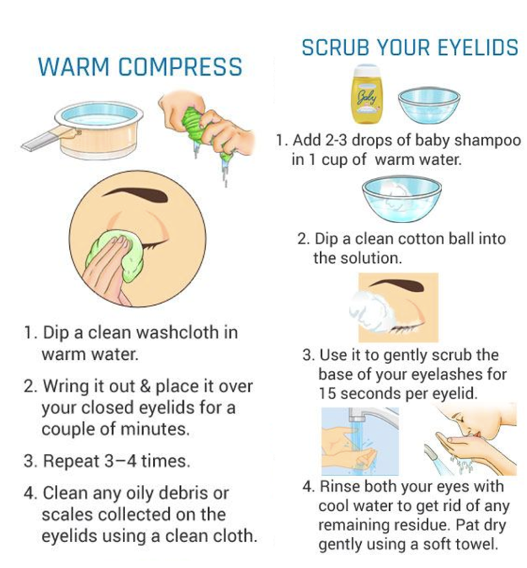 understanding-eyelid-drooping-causes-symptoms-and-treatment-options