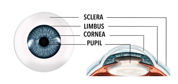 scleritis